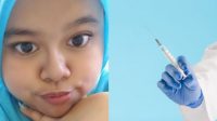 Penampilan Baru Kekeyi Setelah Filler Hidung, Ternyata Seperti Ini Prosedurnya!