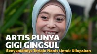 Senyuman 7 Artis Cantik Punya Gigi Gingsul