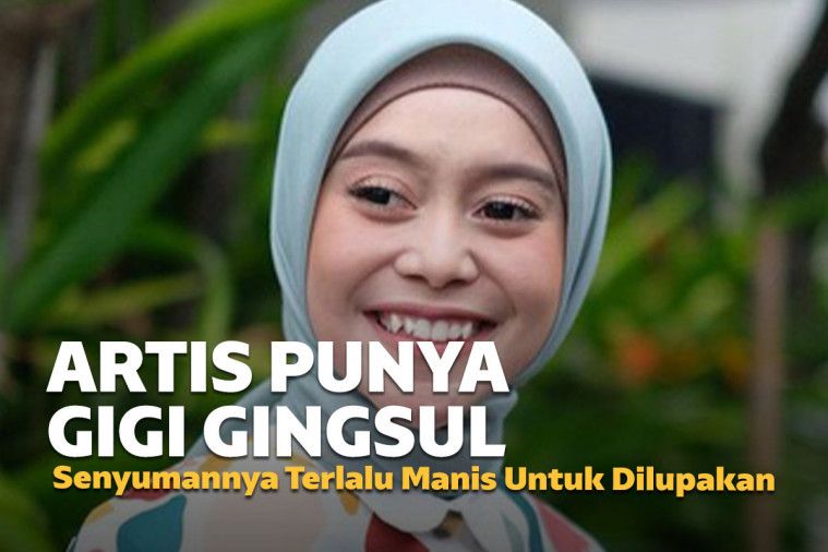 Senyuman 7 Artis Cantik Punya Gigi Gingsul