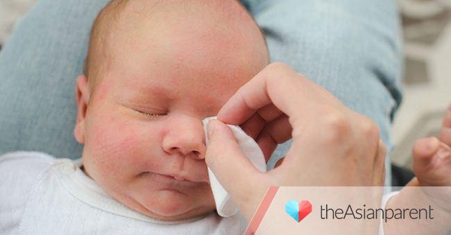 Mata bayi sering belekan, kapan harus merasa khawatir? Ini penjelasan lengkapnya