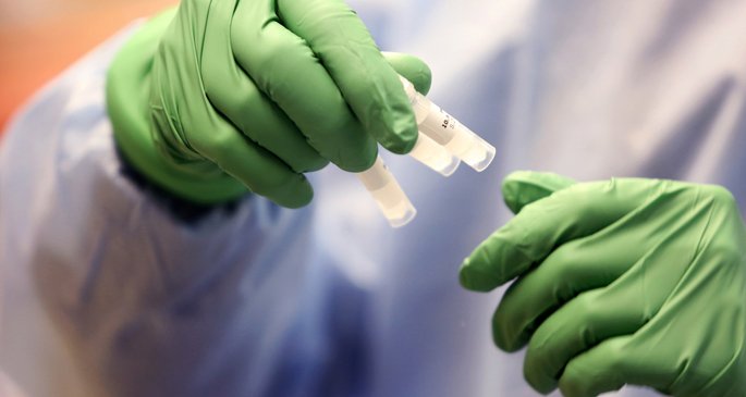 Antibodi yang ditemukan di Vanderbilt untuk pencegahan COVID-19 diberikan otorisasi penggunaan darurat FDA – Majalah Time.com